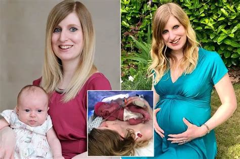 2 vaginas|Mum born with two vaginas says she uses one for husband and。